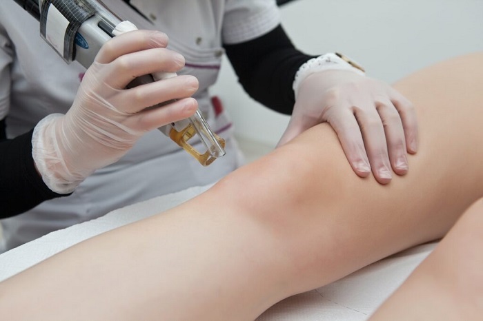 Finding the Best Laser Hair Removal